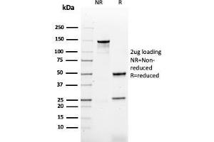 SDS-PAGE Analysis Purified HPV-16 Mouse Recombinant Monoclonal Antibody (rHPV16L1/1058). (Recombinant HPV16 antibody)
