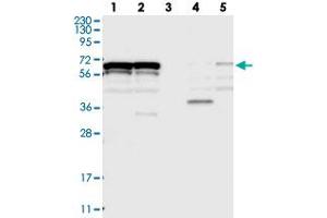 Western blot analysis of Lane 1: RT-4, Lane 2: U-251 MG, Lane 3: Human Plasma, Lane 4: Liver, Lane 5: Tonsil with ZNF655 polyclonal antibody  at 1:250-1:500 dilution.