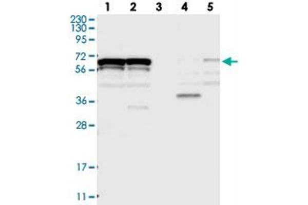 ZNF655 anticorps