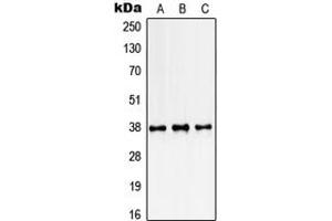 Western blot analysis of SSBP2 expression in K562 (A), NIH3T3 (B), rat kidney (C) whole cell lysates.