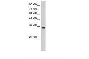 Image no. 2 for anti-Muscleblind-like Protein 1 (MBNL1) (AA 211-260) antibody (ABIN6736245) (MBNL1 antibody  (AA 211-260))