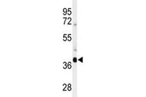 Western blot analysis of SIRT3 antibody and mouse brain tissue lysate (SIRT3 antibody  (AA 304-334))