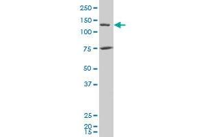 JMY polyclonal antibody (A01), Lot # 060717JCS1 Western Blot analysis of JMY expression in Y-79 . (JMY antibody  (AA 535-634))