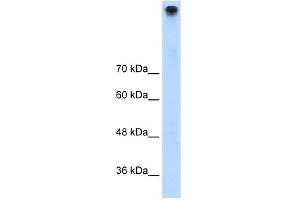 WB Suggested Anti-TRPM3 Antibody Titration:  1.