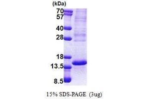 SDS-PAGE (SDS) image for P53-Regulated Apoptosis-Inducing Protein 1 (TP53AIP1) (AA 1-124) protein (His tag) (ABIN5853177)