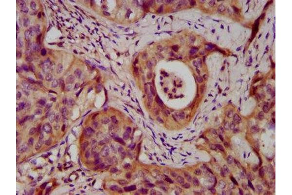 Desmocollin 3 antibody  (AA 712-896)