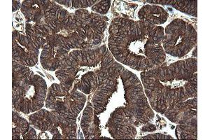 Image no. 1 for anti-Receptor Accessory Protein 5 (REEP5) antibody (ABIN1500659) (REEP5 antibody)