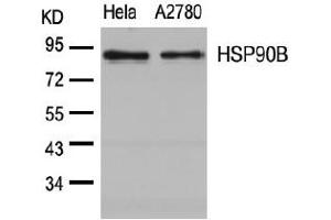 Image no. 3 for anti-Heat Shock Protein 90kDa alpha (Cytosolic), Class B Member 1 (HSP90AB1) (Ser254) antibody (ABIN197568) (HSP90AB1 antibody  (Ser254))