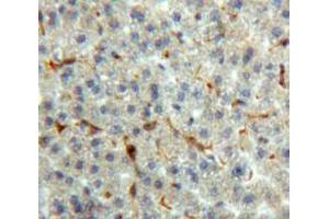 Used in DAB staining on fromalin fixed paraffin-embedded Liver tissue (Prothrombin antibody  (AA 44-198))