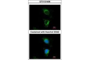 Image no. 3 for anti-Dihydrouridine Synthase 2-Like (DUS2L) (AA 1-199) antibody (ABIN1497929) (DUSL2 antibody  (AA 1-199))