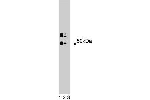 Western blot analysis of HDAC3 on a human endothelial cell lysate. (HDAC3 antibody  (AA 309-425))
