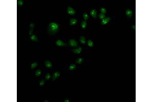 Immunofluorescence staining of Hela cells with ABIN7144542 at 1:110,counter-stained with DAPI. (ALOX5 antibody  (AA 2-149))
