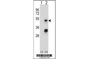 Western blot analysis of HAT1 using rabbit polyclonal HAT1 Antibody using 293 cell lysates (2 ug/lane) either nontransfected (Lane 1) or transiently transfected (Lane 2) with the HAT1 gene. (HAT1 antibody  (N-Term))