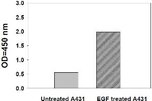 Image no. 1 for Signal Transducer and Activator of Transcription 5A (STAT5A) ELISA Kit (ABIN1981730) (STAT5A ELISA Kit)