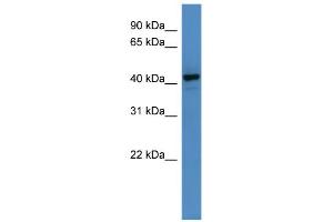 WB Suggested Anti-RNF128 Antibody Titration: 0. (RNF128 antibody  (C-Term))