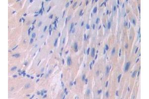 Used in DAB staining on fromalin fixed paraffin- embedded liver tissue (IL18RAP antibody  (AA 396-548))