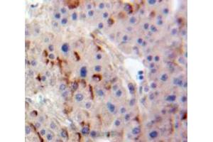 Used in DAB staining on fromalin fixed paraffin-embedded Liver tissue (ADCY4 antibody  (AA 352-541))