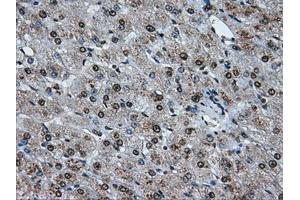 Image no. 16 for anti-ATP Synthase, H+ Transporting, Mitochondrial F1 Complex, beta Polypeptide (ATP5B) antibody (ABIN1496766) (ATP5B antibody)