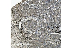 IHC analysis of Integrin beta 5/ITGB5 using anti-Integrin beta 5/ITGB5 antibody (ABIN7601319). (Integrin beta 5 antibody  (AA 32-689))