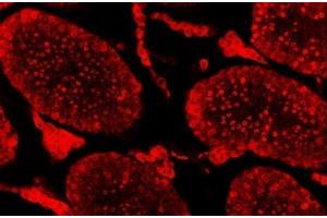 IF analysis of SAE1 using anti-SAE1 antibody (ABIN7601346). (SAE1 antibody  (AA 33-299))