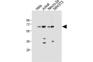 All lanes : Anti-SD4 Antibody  at 1:1000 dilution Lane 1: Hela whole cell lysate Lane 2: Jurkat whole cell lysate Lane 3: Neuro-2a whole cell lysate Lane 4: NIH/3T3 whole cell lysate Lysates/proteins at 20 μg per lane. (SMAD4 antibody  (AA 255-284))