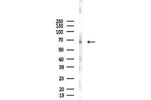 anti-Tectonic Family Member 3 (TCTN3) (Internal Region) antibody