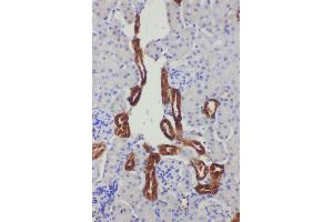 Anti-Kallikrein 1 antibody, IHC(P) IHC(P): Mouse Kidney Tissue (Kallikrein 1 antibody  (C-Term))