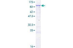 Image no. 1 for Ecto-NOX Disulfide-Thiol Exchanger 1 (ENOX1) (AA 1-643) protein (GST tag) (ABIN1352817) (ENOX1 Protein (AA 1-643) (GST tag))