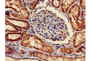 Immunohistochemistry of paraffin-embedded human kidney tissue using ABIN7148332 at dilution of 1:100 (C1QA antibody  (AA 26-125))