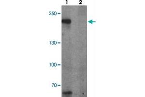 Western blot analysis of TET3 in SK-N-SH cell lysate with TET3 polyclonal antibody  at 1 ug/ml in (1) the absence and (2) the presence of blocking peptide. (TET3 antibody  (AA 1520-1570))
