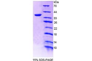 SDS-PAGE analysis of Human TMEM1 Protein. (TRAPPC10 Protein)