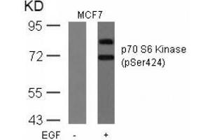 Image no. 3 for anti-Ribosomal Protein S6 Kinase, 70kDa, Polypeptide 1 (RPS6KB1) (pSer424) antibody (ABIN197052) (RPS6KB1 antibody  (pSer424))
