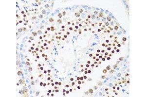 Immunohistochemistry of paraffin-embedded Mouse testis using DDX21 Polyclonal Antibody at dilution of 1:100 (40x lens). (DDX21 antibody)