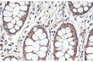 Immunohistochemistry of paraffin-embedded Human colon using APC Polyclonal Antibody at dilution of 1:200 (40x lens). (APC antibody)