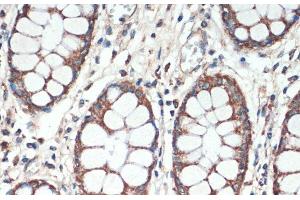 Immunohistochemistry of paraffin-embedded Human colon using APC Polyclonal Antibody at dilution of 1:200 (40x lens).