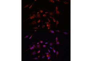 Immunofluorescence analysis of C6 cells using TMEM11 antibody (ABIN7270952) at dilution of 1:100. (TMEM11 antibody  (AA 1-80))