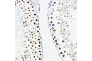 Immunohistochemistry (IHC) image for anti-Zinc Finger E-Box Binding Homeobox 1 (ZEB1) (AA 1-260) antibody (ABIN6150422)