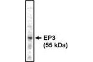Western blot analysis using EP3 antibody on bovine brain lysate at 1 µg/ml. (PTGER3 antibody)