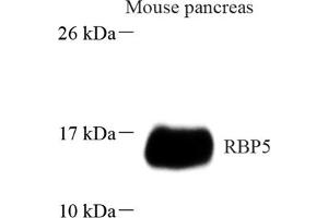 Western blot analysis of RBP5 (ABIN7075410) at dilution of 1: 1000 (Retinol Binding Protein 5 antibody)