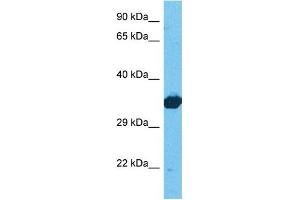 Host:  Rabbit  Target Name:  LDHB  Sample Tissue:  Human 293T Whole Cell  Antibody Dilution:  1ug/ml (LDHB antibody  (C-Term))