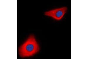 Immunofluorescent analysis of Caspase 10 staining in Jurkat cells. (Caspase 10 antibody  (C-Term))
