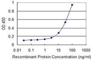 Detection limit for recombinant GST tagged PSTPIP1 is 1 ng/ml as a capture antibody. (PSTPIP1 antibody  (AA 1-416))