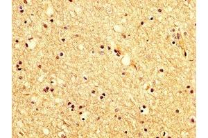 IHC image of ABIN7175618 diluted at 1:200 and staining in paraffin-embedded human brain tissue performed on a Leica BondTM system. (KCNAB1 antibody  (AA 287-401))