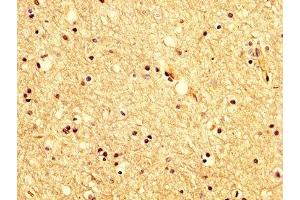 IHC image of ABIN7175618 diluted at 1:200 and staining in paraffin-embedded human brain tissue performed on a Leica BondTM system. (KCNAB1 antibody  (AA 287-401))