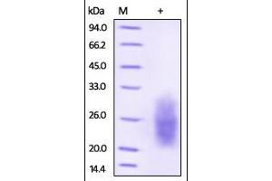 Human NKp30, His Tag on SDS-PAGE under reducing (R) condition. (NCR3 Protein (AA 19-135) (His tag))