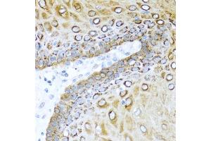 Immunohistochemistry of paraffin-embedded human esophagus using S100/Psoriasin antibody (ABIN3015738, ABIN3015739, ABIN3015740 and ABIN6219085) at dilution of 1:100 (40x lens). (S100A7 antibody  (AA 1-101))