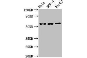 Western Blot Positive WB detected in: Hela whole cell lysate, MCF-7 whole cell lysate, HepG2 whole cell lysate All lanes: CHRNB1 antibody at 3 μg/mL Secondary Goat polyclonal to rabbit IgG at 1/50000 dilution Predicted band size: 57, 50 kDa Observed band size: 57 kDa (CHRNB1 antibody  (AA 24-244))