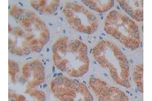 Immunohistochemistry (IHC) image for anti-5'-Nucleotidase, Cytosolic III (NT5C3) (AA 52-336) antibody (ABIN7442483)