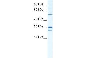 WB Suggested Anti-GJB2 Antibody Titration:  1. (GJB2 antibody  (Middle Region))