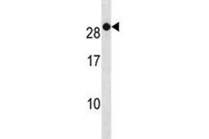 RAB7B antibody western blot analysis in A2058 lysate. (RAB7B antibody  (AA 168-197))